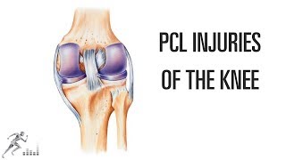 PCL injury of the knee Mechanism of injury and treatment options [upl. by Jacey816]