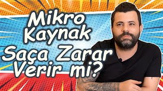 Mikro Kaynak Saça Zarar Verir mi  Toprak Şeker [upl. by Barri726]