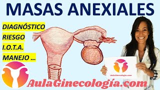 MASAS ANEXIALES DIAGNÓSTICO ECOGRAFÍA CÁLCULO DE RIESGO MANEJO  Ginecología y Obstetricia [upl. by Sifan]