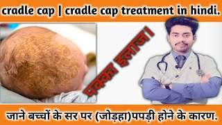 cradle cap  cradil cap treatment  what is cradle cap cause symptoms and treatment [upl. by Ainalem36]