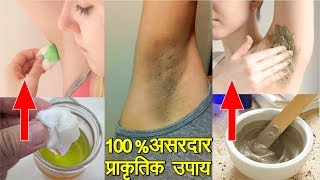 अंडरआर्म्स का कालापन ख़त्म करने के 3 सबसे असरदार उपाय how to Whiten Your Underarms [upl. by Rochemont482]