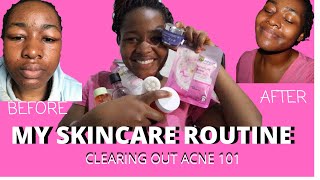 Skincare Routine  After the Duac Gel experience  Skincare [upl. by Anohs]