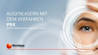 Worldeye Augenlasern mit dem Verfahren PRK [upl. by Emmalee]