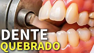 RESTAURAÇÃO DE DENTE EM CASA [upl. by Sorce]