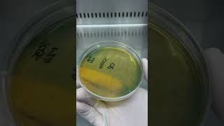 Vibrio cholerae on TCBS Agar shorts [upl. by Anecuza157]