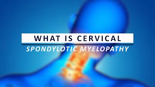 What is Cervical Spondylotic Myelopathy [upl. by Sucam168]