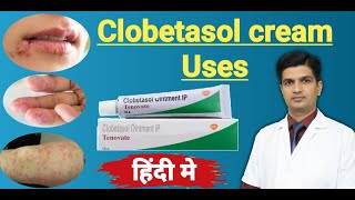 Clobetasol Propionate cream uses  Tenovate cream Uses in hindi [upl. by Sergeant]