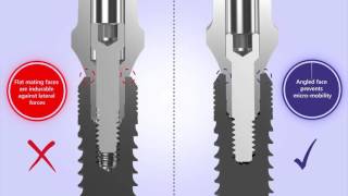 NucleOSS T6 Implant [upl. by Ayortal492]