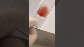 Blood smear 💉🩸  smear practical  blood practical medical neet satyujribadiya doctor shorts [upl. by Yngiram]