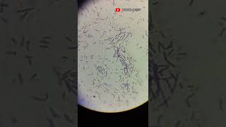 Grampositive Bacilli 100X in compound microscope  clinical microbiology  microbiology [upl. by Psyche]