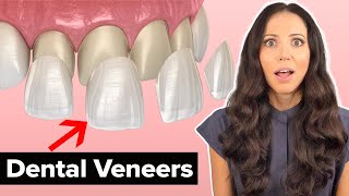 Dental Veneers Procedure Explained [upl. by Kcirdlek176]