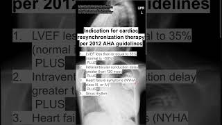 Pharmacology Drugs for Heart Failure Animation [upl. by Elenaj]