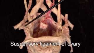 Anatomy Series The Female Urogenital System by Dr Shakti Chandra [upl. by Enyahc334]