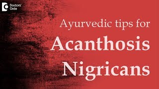 Tips in ayurveda for Acanthosis Nigricans  Dr Mini Nair [upl. by Ruelle898]