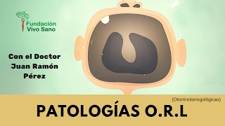 PATOLOGIAS ORL [upl. by Straub]