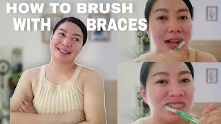 HOW TO BRUSH WITH BRACE BRACES UPDATE AFTER 2ND ADJUSTMENT [upl. by Neumeyer]