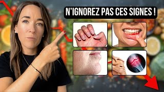 CES 11 SIGNES montrent que votre CORPS MANQUE DE NUTRIMENTS ESSENTIELS naturopathie [upl. by Epps]