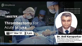 Thrombectomy for acute stroke [upl. by Stelu]