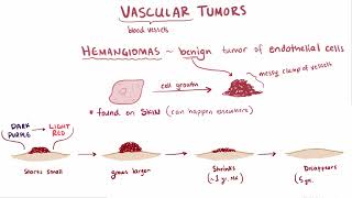 Glomus Tumor  Osmosis [upl. by Nylirahs141]