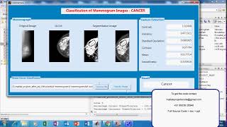 Classification of Mammogram Images using GLCM and Trace Transform Functionals [upl. by Nessie246]