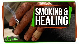 Why Smoking Makes It Harder to Heal [upl. by Ayenet]