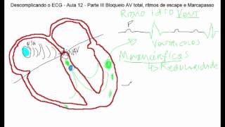 Descomplicando o ECG  Aula 12 parte 3  BAVT Ritmo de escape e Marcapasso [upl. by Ariaek263]