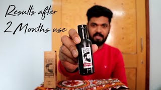 Beardo hair growth oil  Review amp usage technique  After 2 month use [upl. by Guthry]