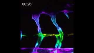 Endothelial cells in pten mutant zebrafish embryos form filopodia over time [upl. by Philender]