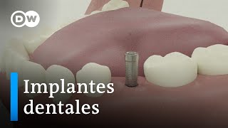 Implantes dentales ventajas e inconvenientes [upl. by Sabsay505]