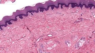 HISTOLOGI HUD DERMIS OG SUBCUTIS [upl. by Gerry]