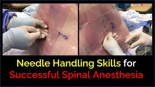 Successful Spinal Anesthesia  Skillful Needle Handling [upl. by Cicily]