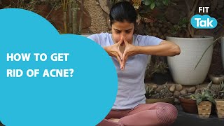 Acne Problems  Face Yoga For Acne  Get Rid of Acne Problems  Yoga With Mansi  Fit Tak [upl. by Isiahi150]