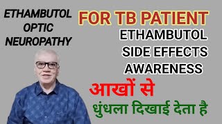 टीबी की दवा और आखो से कम दिखाई देनाETHAMBUTOL TOXICITY SIDE EFFECTS OF ETHAMBUTOL [upl. by Yereffej441]