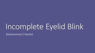 Incomplete Eyelid Blink [upl. by Annoik]