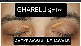 AANKHON PAR PEELE CHAKTE XANTHELASMA  AAPKE SAWAAL MERE JAWAAB [upl. by Orravan935]