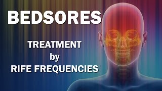 Bedsores Pressure Sores  RIFE Frequencies Treatment  Energy amp Quantum Medicine with Bioresonance [upl. by Donielle]