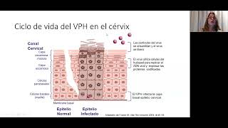 132024 MÓDULO GINECOLOGÍA ONCOLÓGICA Ginecooncología [upl. by Gracia]