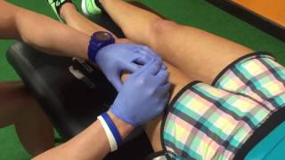 Functional Dry Needling [upl. by Lanod]