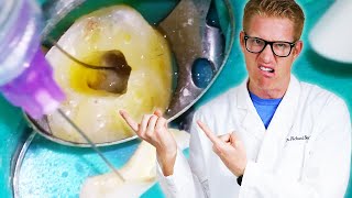 Dentist Explains Every TOOTH PAIN AFTER ROOT CANAL TREATMENT Throbbing Relief Months or Years Later [upl. by Okramed998]