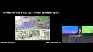 2015 SID State of the Art SOTA Plenary Lecture 1 Valentina Greco PhD [upl. by Blanche]