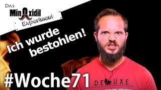 Ich wurde bestohlen  Das Minoxidil Experiment Woche71 [upl. by Edward]