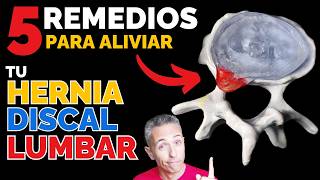 5 REMEDIOS CASEROS para ALIVIAR una HERNIA DISCAL LUMBAR [upl. by Eemyaj]