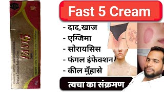 मात्र 5 दिन मे दाद खाज खुजली जड़ खत्म  dad khaj khujali ki dava  Fast 5 cream uses in Hindi [upl. by Mata]