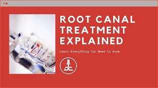 StepbyStep The Root Canal Process Explained [upl. by Asille937]