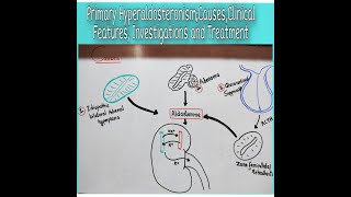 Primary HyperaldosteronismCausesClinical Features Investigations and Treatment [upl. by Ahsenyl93]