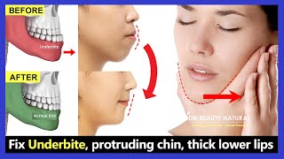 5 Exercises Fix Underbite without surgery fix protruding chin reduce thick lower lip [upl. by Naleag]