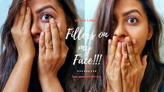 Tried Hyaluronic Acid Fillers on my Face  Indian Vlog Kosmoderma Experience [upl. by Aicac]