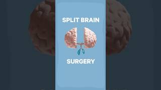 Can you split consciousness  science neuroscience experiment [upl. by Idnac]