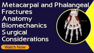 Metacarpal and Phalangeal Fractures  Anatomy  Biomechanics  Surgical Considerations [upl. by Wenona]