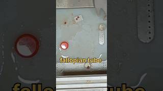 Fallopian tube biopsy 🧐 sample  sterilization [upl. by Feldman]